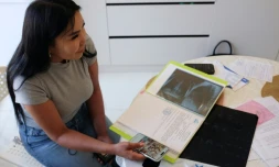 iana Tergenbaïeva, victime d'une intervention de chirurgie esthétique ratée, lors d'un entretien avec l'AFP à Bichkek, le 15 mai 2026 au Kirghizstan