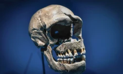 Les malades du Covid-19 portant un segment d'ADN de Neanderthal, hérité d'un croisement avec le génome humain il y a quelques 60.000 ans, sont plus à risques de complications sévères de la maladie, selon des chercheurs.