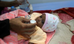 Un nourrisson souffrant de malnutrition dans un hôpital de la ville portuaire de Hodeidah au Yémen, le 3 décembre 2017