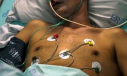 Un patient atteint du Covid-19 admis en soins intensifs à l'hÎpital Emilio Ribas de Sao Paulo, au Brésil, le 17 mars 2021