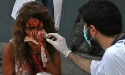 Un médecin soigne une femme devant un hÎpital le 4 août 2020 aprÚs deux énormes explosions à Beyrouth