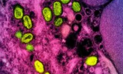 Image de l'Institut américain des allergies et maladies infectieuses (NIAID) de Bethesda montrant le Mpox