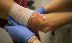 Les études montrent que de plus en plus d'Américains se font tatouer (un adulte sur cinq selon l'une d'elles), mais qu'ils sont aussi de plus en plus nombreux à le regretter