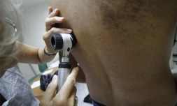 Jeudi 27 Mai 2010
Consultation par un Dermatologue