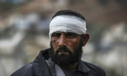 Un Syrien blessé à son arrivée le 16 décembre 2016 à Bab al-Hawa à la frontière de la Syrie et de la Turquie, après avoir été évacué d'Alep