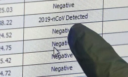 Coronavirus: entre cas réels et cas détectés, l'épidémie avance masquée