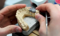 Un prothésiste travaille sur une dent en céramique. Parmi ce qui change au 1er avril: le plafonnement des prix de certaines prothèses dentaires