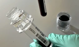 Depuis que le sport de compétition existe, les athlÚtes comptent sur les fortifiants les plus divers -certains peu ragoûtants, d'autres carrément dangereux- pour remporter des médailles, sans se soucier de leur santé