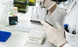 Etude et analyse d'échantillons positifs au Covid-19 pour le variant britannique, le 15 janvier 2021 à Aalborg, au Danemark 
