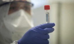 Des tests sur un échantillon potentiellement infecté par Covid-19 à l'hôpital Henri Mondor à Créteil dans le Val-de-Marne, le 6 mars 2020