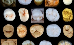 Des dents d'hominidés trouvées dans les cavernes de Sima de los Huesos en Espagne, publiées par le University CollÚge de Londres