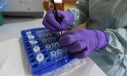 Au laboratoire de lâInstitut de recherche et de lutte contre la fiĂšvre de Lassa, Ă lâhĂŽpital universitaire spĂ©cialisĂ© dâIrrua, Ă Irrua, dans lâĂtat dâEdo, au centre-ouest du Nigeria, le 6 mars 2018