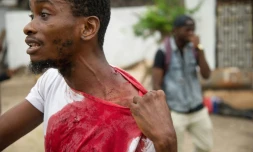 Un homme montre ses blessures, le 20 septembre 2016, prĂšs des locaux du principal parti d'opposition, Ă Kinshasa