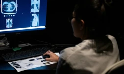 Une technicienne en radiologie médicale, travaille dans la salle de "tomographie volumique à faisceau conique" (CBCT) du centre médical Zoï, une start-up proposant des bilans de santé personnalisés à Paris, le 24 février 2026