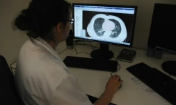 Un médecin regarde une raio des poumons à l'Institut Universitaire du Cancer de Toulouse (IUCT) le 4 juin 2015