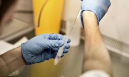 Parents et enfants accusent le directeur d'une banque de sperme d'avoir lui-même donné son sperme au lieu de celui du donneur choisi par les parents