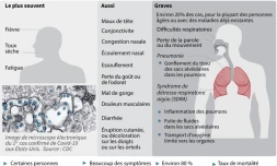 Les principaux symptĂŽmes du Covid-19