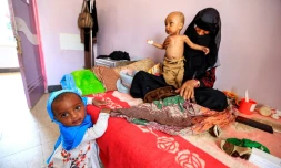Des enfants souffrant de malnutrition dans un hôpital de Sanaa, au Yémen, le 22 juin 2019