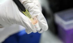 Les cellules cancéreuses perdent de petits fragments d'ADN en circulant dans le sang et ceux-ci peuvent être collectés et analysés en laboratoire pour décider de la thérapie à suivre