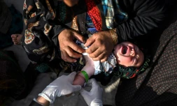 Un membre du personnel de Médecins sans frontiÚres (MSF) observe les signes de malnutrition d'un enfant dans un camp de personnes, prÚs de Hérat, le 22 novembre 2021 en Afghanistan
