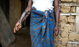 Le pangolin apprécié au Liberia pour sa viande au goût de sucre et pour ses écailles recherchées en Asie. A Gbarpolu county, le 14 novembre 2021