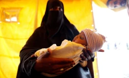 Une mère yéménite avec son enfant soupçonné d'être infecté par le choléra à Sanaa, le 9 juin 2017 