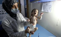 Une infirmière porte une petite fille syrienne souffrant de malnutrition aiguë, le 21 octobre 2017 dans un hôpital de Hamouria, dans la Ghouta orientale