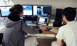 Des médecins regardent la radio des poumons d'un patient à l'Institut Universitaire du Cancer de Toulouse, le 4 juin 2015