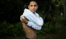 Anthony Borges dévoile ses cicatrices lors d'une interview avec l'AFP à Coral Springs en Floride, le 9 août 2019. L'adolescent a été blessé le 14 février 2018 lors de la fusillade de Parkland