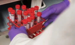 L'ONU entend réduire d'ici 2030 de 30% les décès prématurés dus à des maladies chroniques (cancers, maladies cardiovasculaires, diabète...), dites maladies non transmissibles