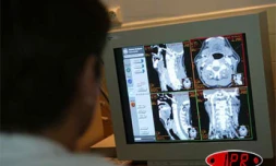 Imagerie médicale