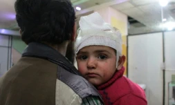 Enfant blessé dans un hÎpital de fortune aprÚs des frappes du régime sur la ville rebelle de Douma, prÚs de Damas, le 7 février 2018