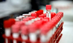 Tests sérologiques pour rechercher le Covid-19 analysés par un laboratoire en région parisienne, le 22 avril 2020