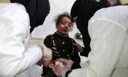Une fillette syrienne blessée dans des bombardements soignée à Douma, aux abords de Damas, le 6 janvier 2018