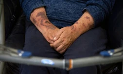 Les bras de Marisela Oliva bleuis par les coups de son ex-compagnon, le 20 juin 2021 à Mexico