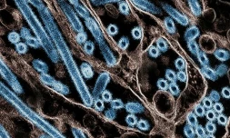 Pour la première fois, la grippe aviaire a tué un patient humain aux Etats-Unis. Plusieurs experts estiment depuis des mois que les autorités sanitaires américaines ne prennent pas assez la mesure de cette menace de santé publique