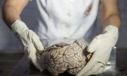 La doctoresse Diana Rivas manipule un cerveau humain extrait d'un bocal de formol au musée de neuropathologie de Lima, le 16 novembre 2016