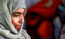 La Yéménite Al-Anoud Hussein Chariane, 19 ans, mariée à 12 ans, répudiée à 16 et défigurée à l'acide par son ex-mari, reçoit un traitement dans un hÎpital de Sanaa, le 28 janvier 2021