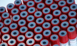 Test coronavirus