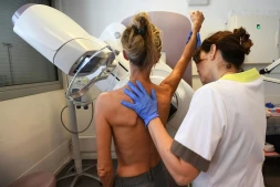 dépistage cancer