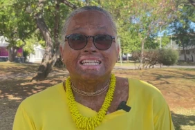 Géraldine Adolphe est porteuse de plusieurs handicaps invisibles