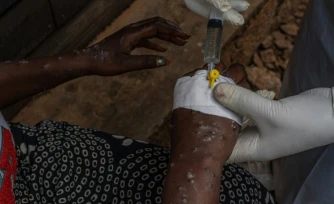 Une patiente atteinte du mpox reçoit un traitement en intraveineuse à l'hôpital de Kavumu, au nord de Bukavu, dans l'est de la RDC, le 24 août 2024