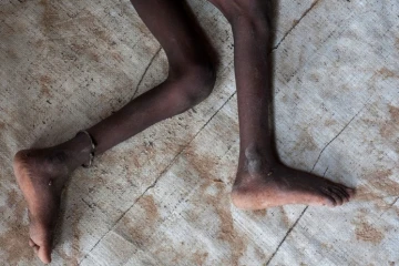 Enfants morts de faim AFP 