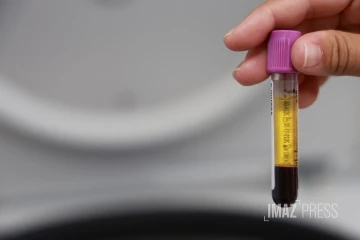  chikungunya analyse sang 