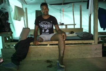 Jair, ancien combattant des Farc blessé il y a 6 ans lors du conflit, s'entretient avec l'AFP, le 2 janvier 2017, depuis le campement des Farc à Vegaez 