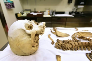 Dans le cabinet de Gregory Hess, médecin légiste dans l'Arizona, le squelette d'une personne ayant tenté de traverser la frontière entre le Mexique et les Etats-Unis
