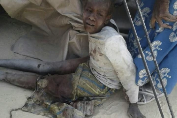 Un enfant blessé dans un bombardement accidentel d'un camp de déplacés à Rann, au Nigeria, le 17 janvier 2017