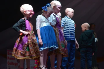 Des enfants albinos participent à l'élection des premiers Miss et Mister Albinisme Kenya, le 21 octobre 2016 à Nairobi