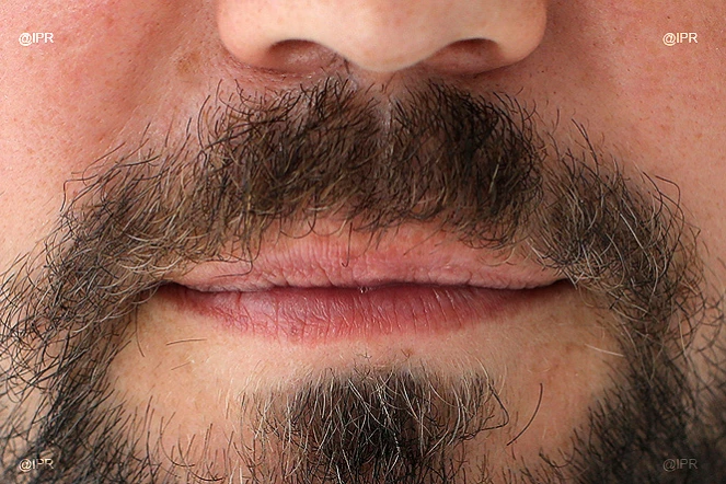 "Movember" : la moustache contre le cancer