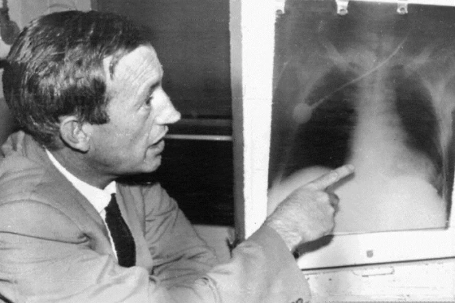 Christiaan Barnard le chirurgien sud-africain qui a pratiqué la première greffe du c?ur montre une radiographie du receveur Louis Washkansky, le 1er décembre 1992 au Cap